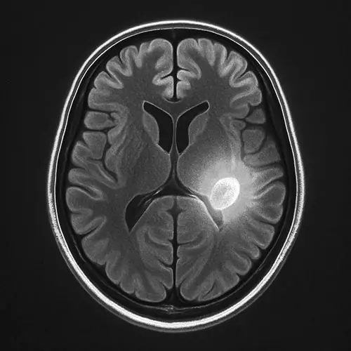 Brain scan showing anxiety response, keyword: neuroscience of guilt